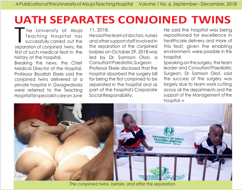 The conjoined twins before and after separation at UATH